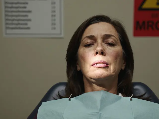 Osteoporosis Medications: Understanding Bisphosphonate Risks and Jaw Necrosis